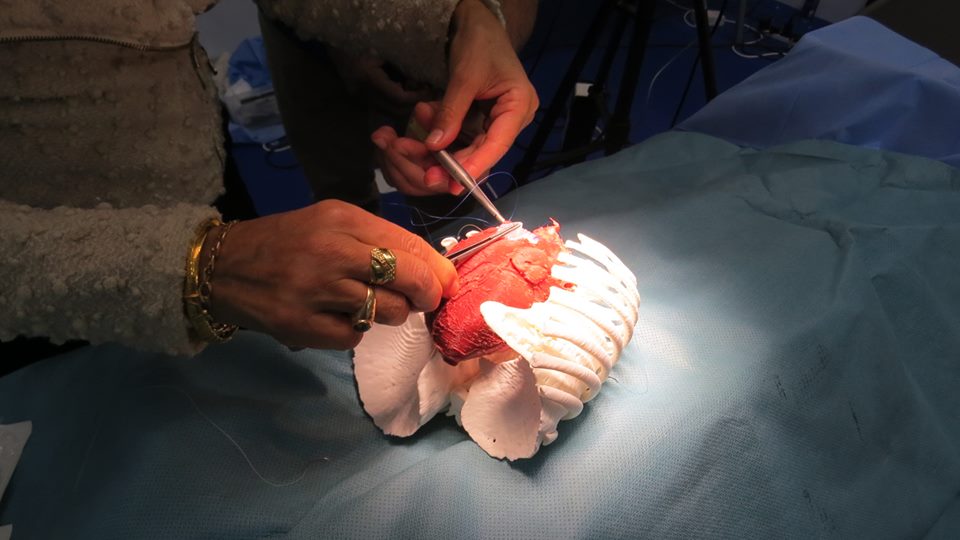 A surgeon simulates surgery on a 3D printed model